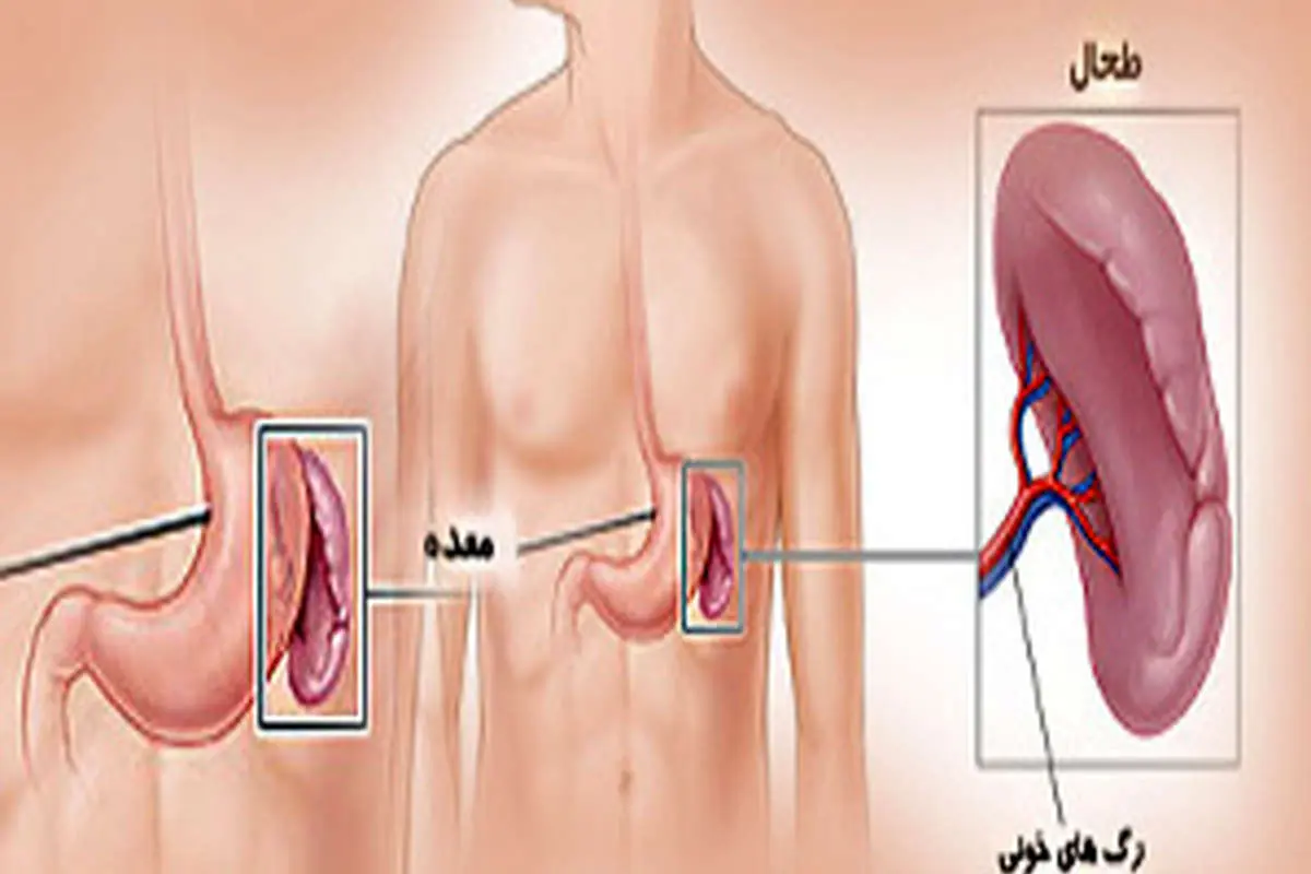 عکس طحال